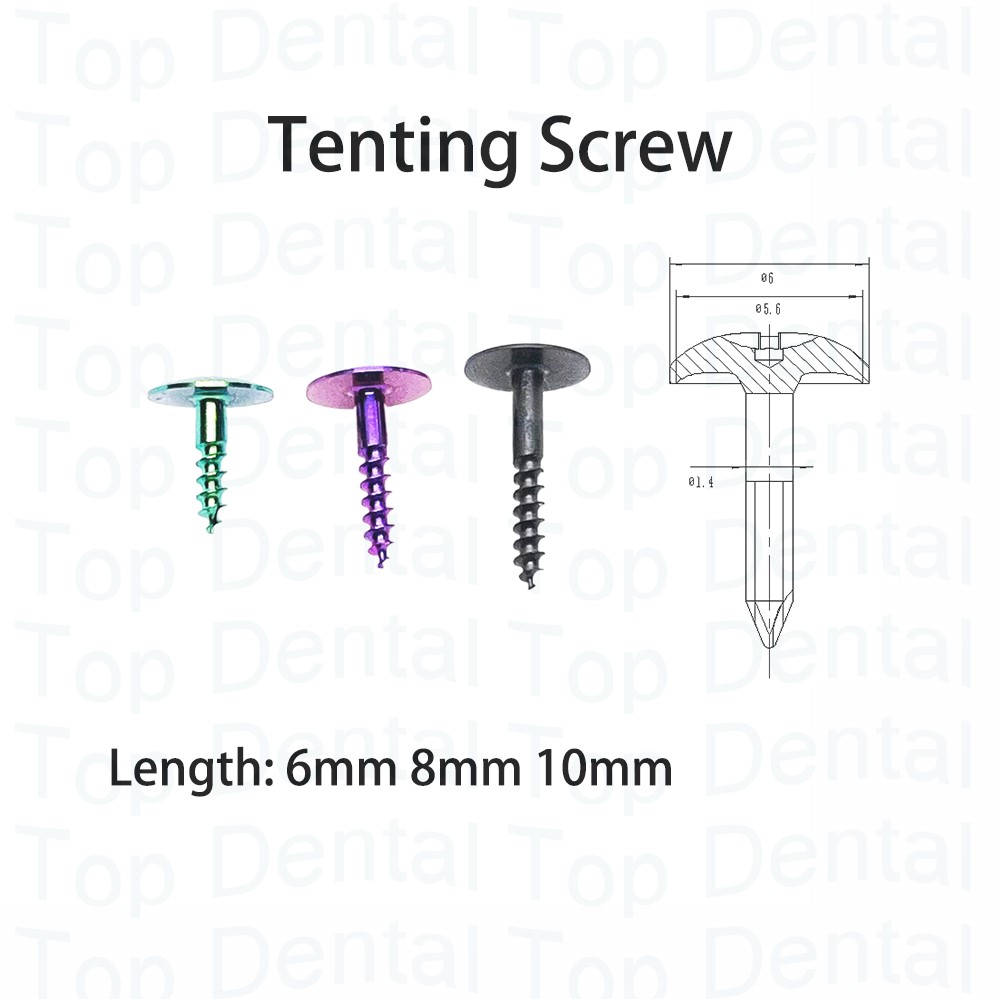 10pcs Dental GBR System Bone S - Stabilizer Screw In ulasan dan harga