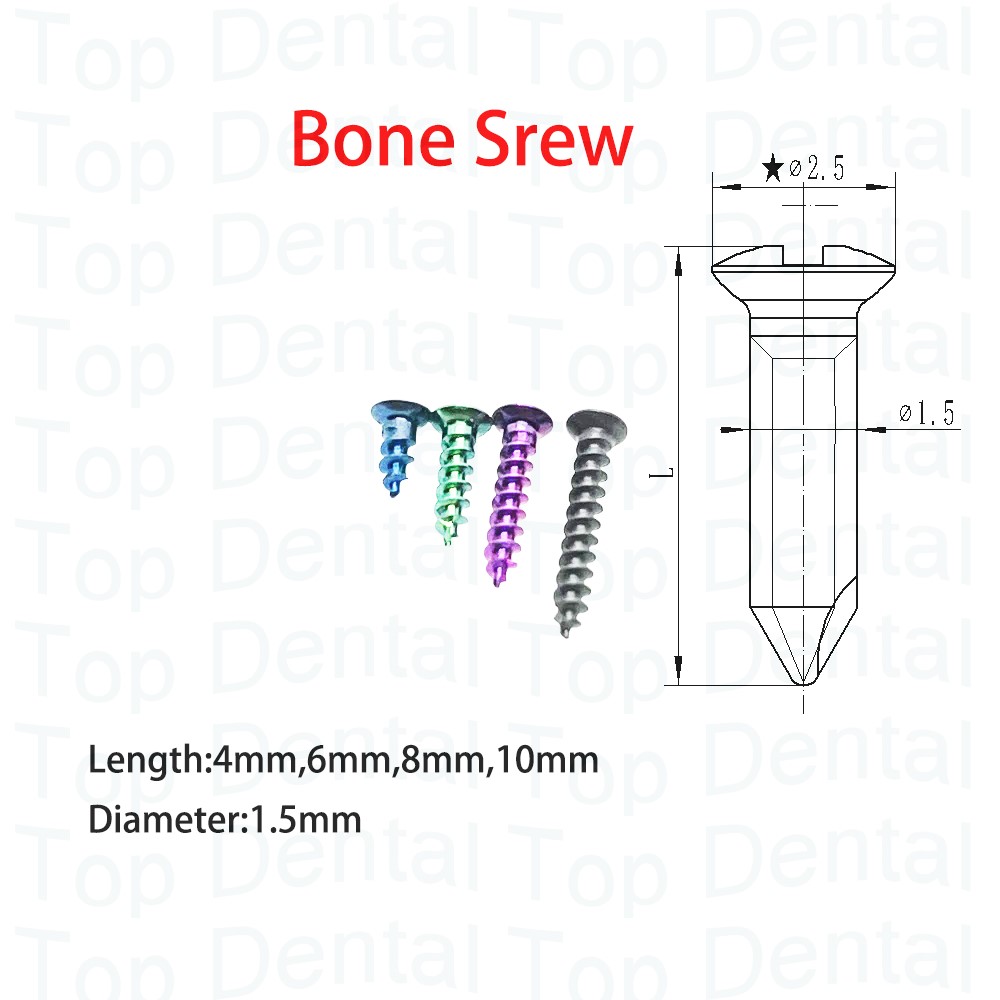 10pcs Dental GBR System Bone S - Stabilizer Screw In ulasan dan harga
